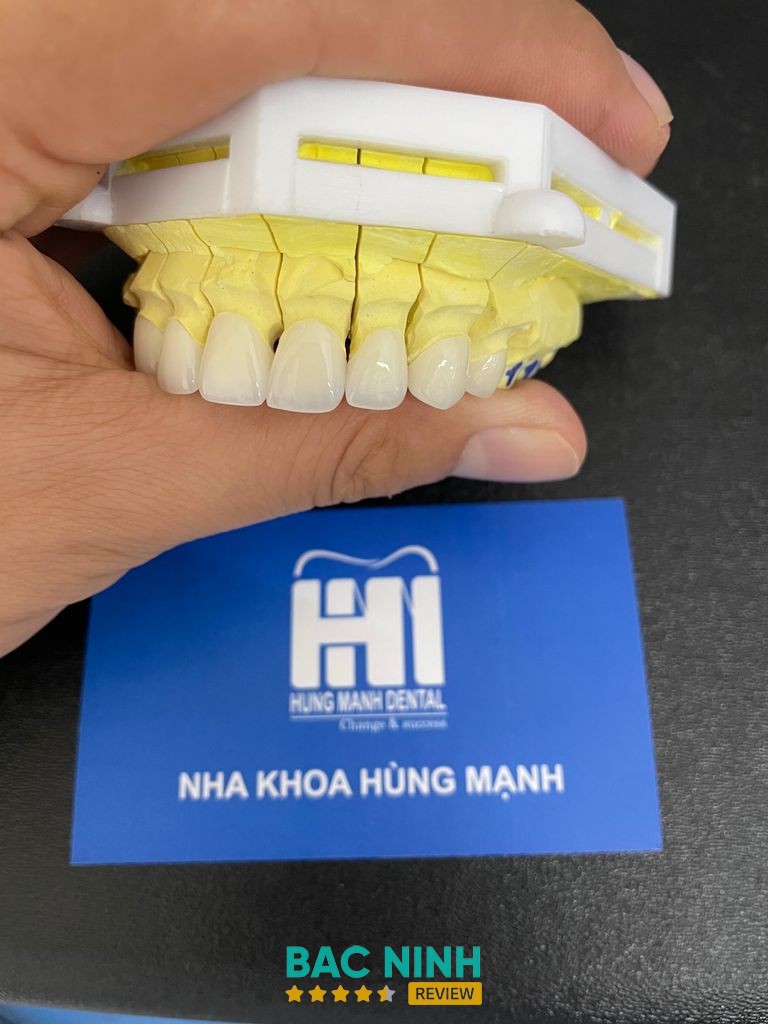Nha Khoa Hùng Mạnh – ảnh 2