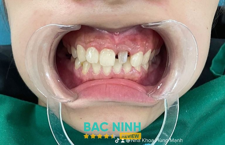 Nha Khoa Hùng Mạnh – ảnh 3