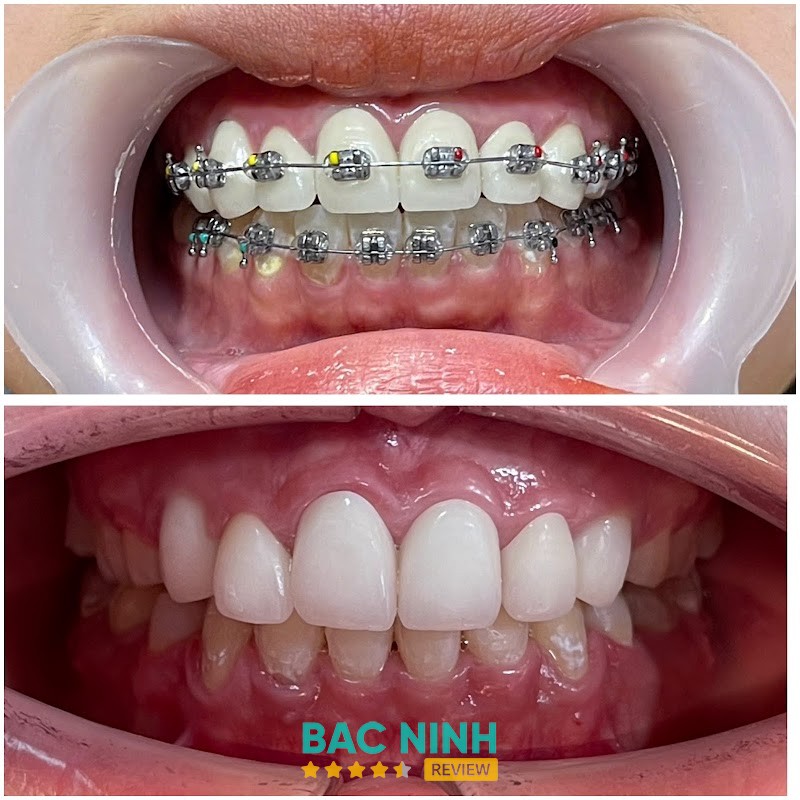 NHA KHOA AN BINH 2 – hình ảnh 3