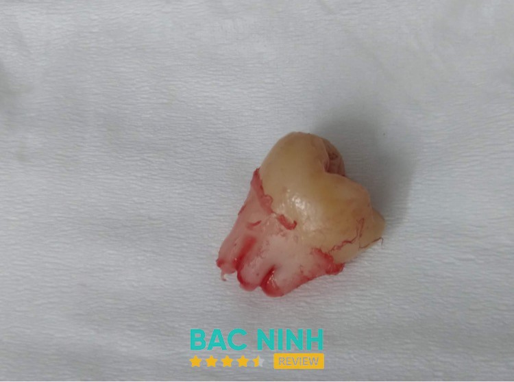 NHA KHOA BÁC SĨ QUYẾT – hình ảnh 3