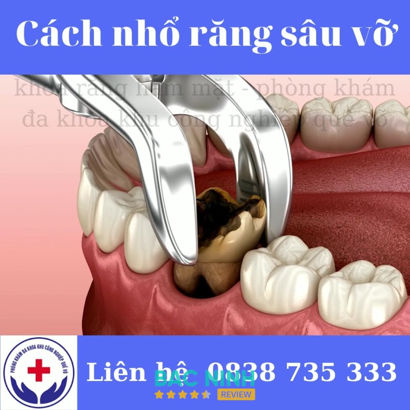 NHA KHOA KHU CÔNG NGHIỆP QUẾ VÕ – hình ảnh 2