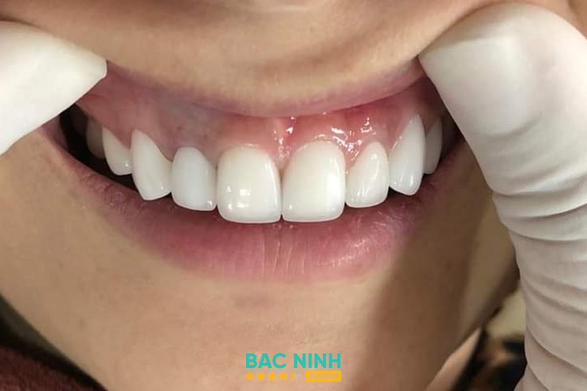 Nha khoa Thu Hằng Phố Hồ Thuận Thành