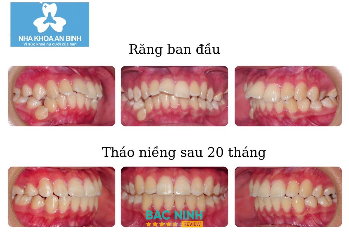 NHA KHOA TÂM BÌNH - Samsung Bắc Ninh - hình ảnh 2