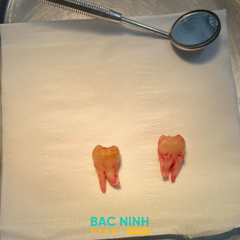 NHA KHOA BÁC SĨ QUYẾT – hình ảnh 3