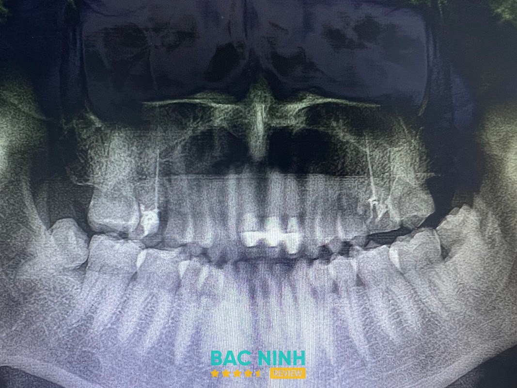 Nha Khoa Tâm Đức Từ Sơn – hình ảnh 3