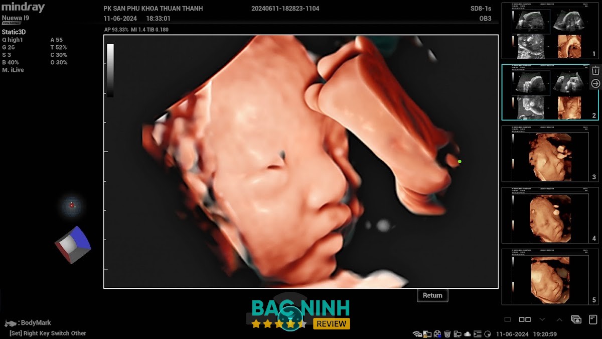Phòng khám sản phụ khoa Thuận Thành – hình ảnh 2