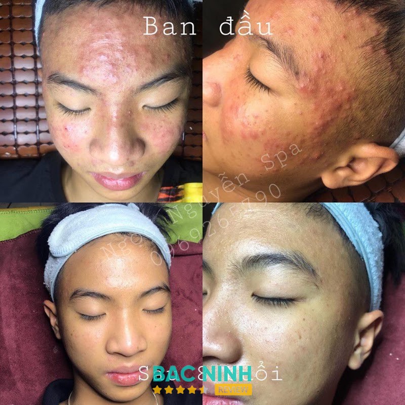 Spa Ngoc Nguyen – hình ảnh 1