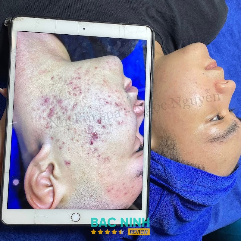 Spa Ngoc Nguyen – hình ảnh 3