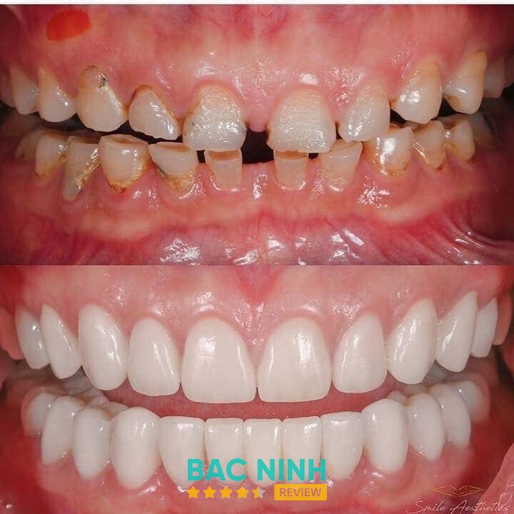 Nha khoa Tâm Đức Phát - Cơ sở 1 Bắc Ninh