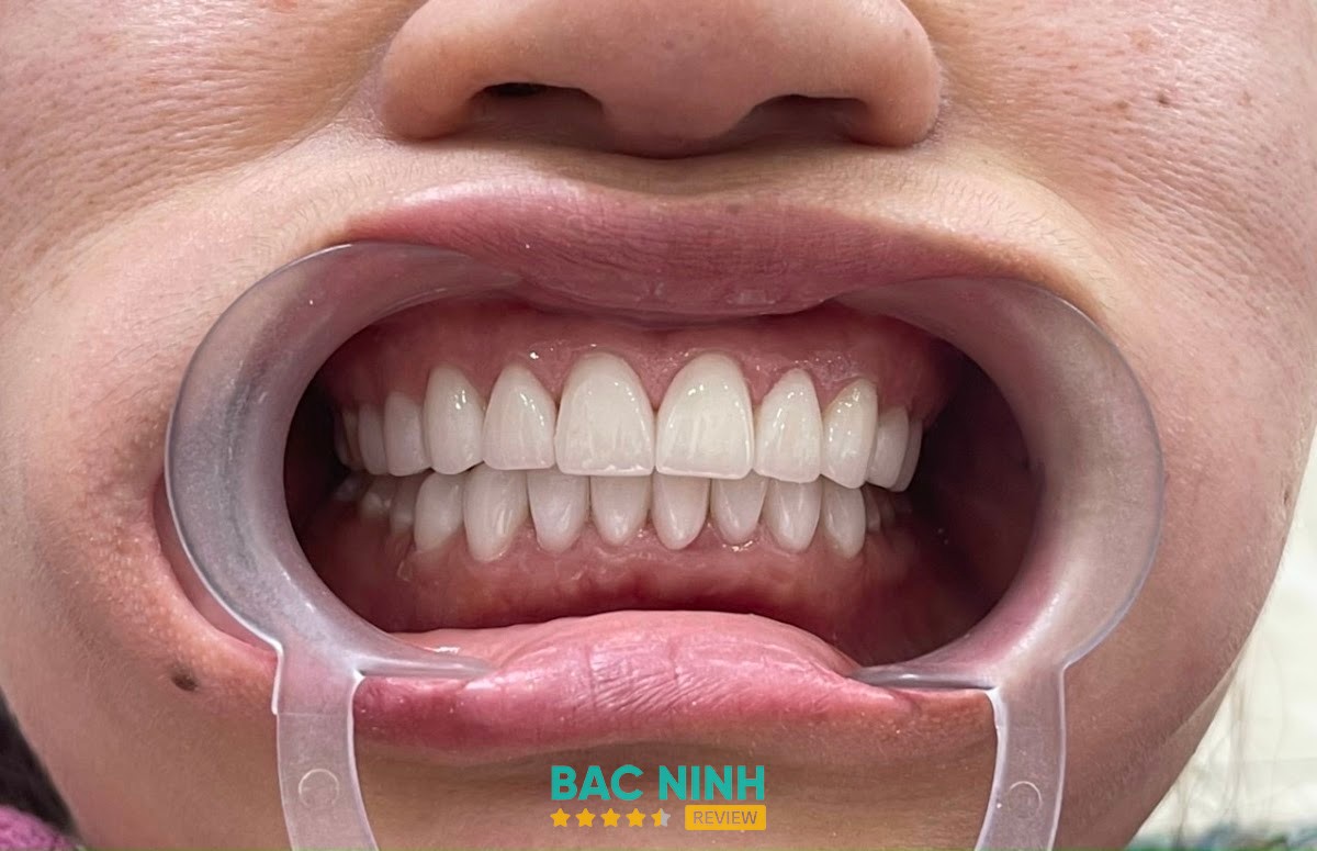 Nha Khoa Bảo Anh – hình ảnh 3